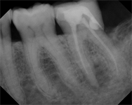 Do you know what kind of endodontics your associate is doing?