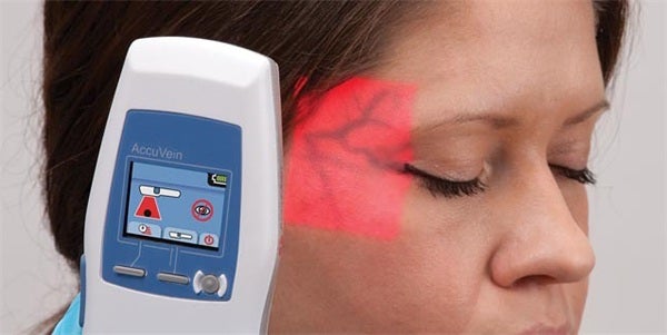 AccuVein in Aesthetic Dentistry: Why It Is a Game Changer for Botox Lip Flips and Lip Filler Precision
