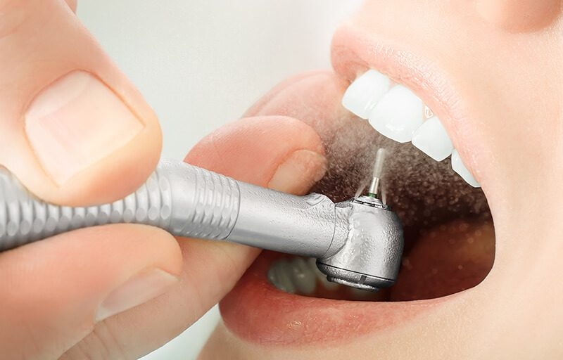 Does Your Dental Marketing Have a Cavity? Don't Wait Till It Hurts.