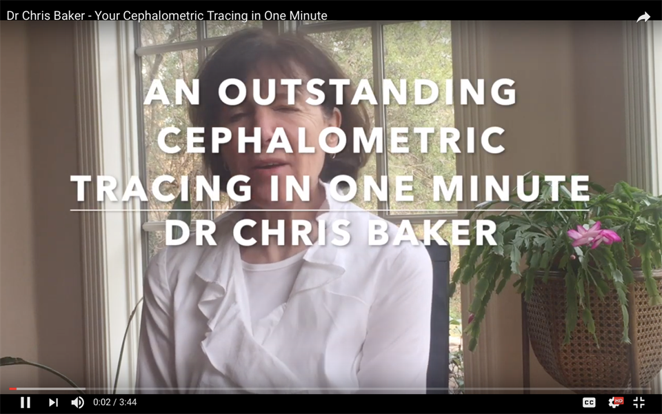 An Outstanding Cephalometric Tracing in One Minute