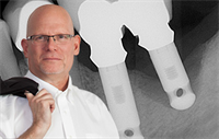 Dentaltown Learning Online....Saving Ailing/Failing Implants with the Laser Assisted Peri-Implantitis Procedure. By Allen Honigman DDS, MS 