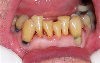Dentaltown Learning Online...Esthetic Dentistry for the Older Patient by Dr. Arnold I Liebman 