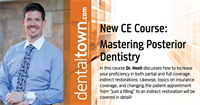 "Mastering Posterior Dentistry" By Dr. John Nosti