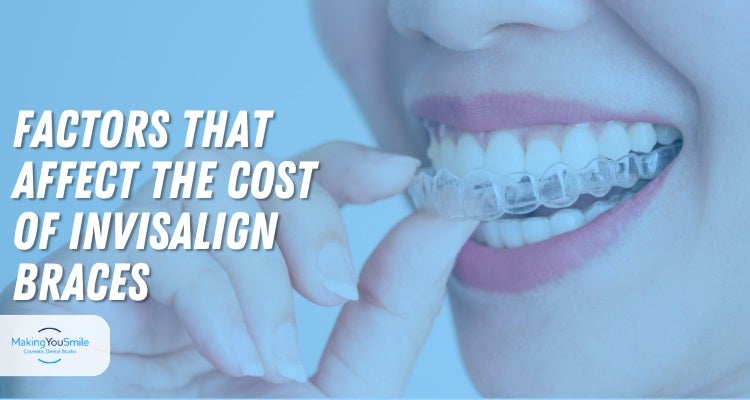  Factors That Affect The Cost of Invisalign Braces