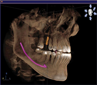 3D Imaging is a Big Leap for Dental Technology