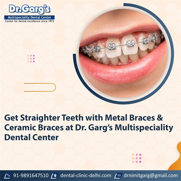 Get Straighter Teeth with Metal Braces and Ceramic Braces at Dr. Garg’s Multispeciality Dental Center