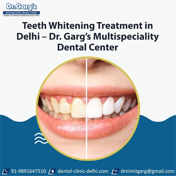 Teeth Whitening Treatment in Delhi – Dr. Garg’s Multispeciality Dental Center