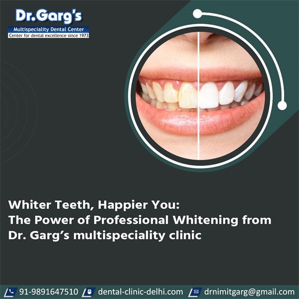Whiter Teeth, Happier You: The Power of Professional Whitening from Dr. Garg’s multispeciality clinic