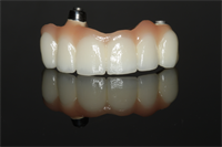 3 Guidelines to Determine When to Use Prosthetic Gingiva!