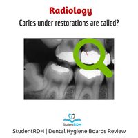 Q: The image highlights which type of caries?