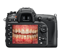 Nikon D7200 Vs Canon 80D Review - Which Is The Best Camera For Dental Photography?