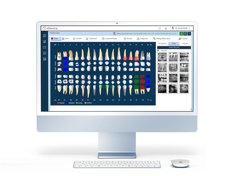 Affordable Dental Practice Management Systems