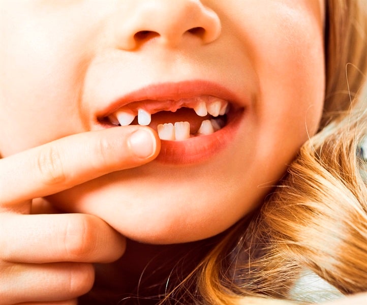 Common Oral Health Problems in Children