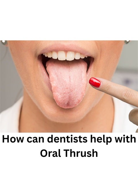 How can dentists help with Oral Thrush?