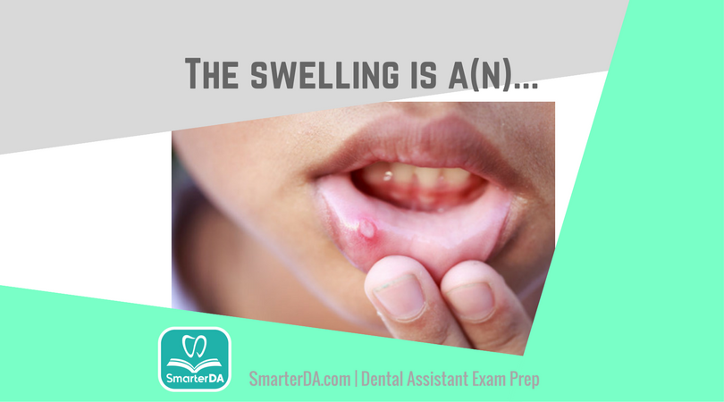 Q: This type of swelling is a(n):