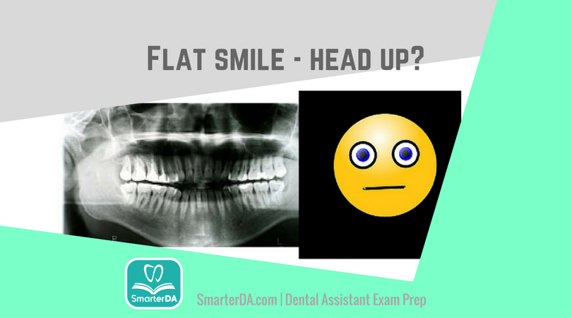 Q: Which radiographic error caused this “flat” smile?