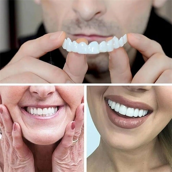 How Veneers Can Transform Your Smile: A Complete Guide