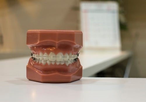 Tooth Polishing for Stubborn Stains