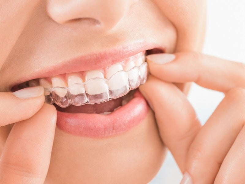Comparing Invisalign Costs Globally: Understanding the Price Variations