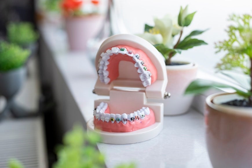 5 Effective Marketing Strategies for Orthodontists