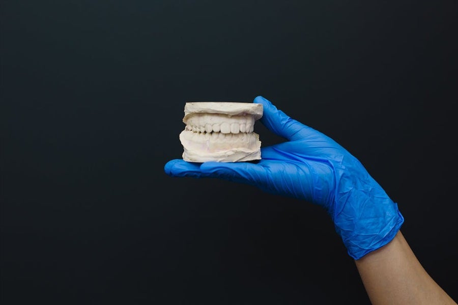 All You Need to Know About Cross bite and Its Treatment