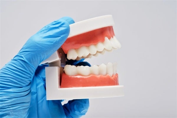 Overdentures Vs. Traditional Dentures: Making an Informed Choice