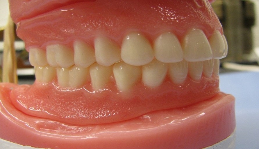 Overdentures Vs. Traditional Dentures: Making an Informed Choice