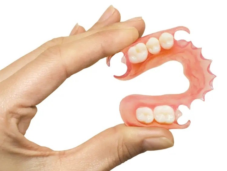 How to Budget for Flexible Partial Dentures Without Breaking the Bank