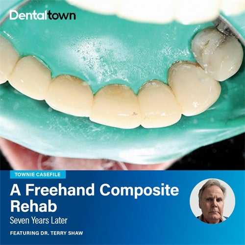 Townie Casefile: A Freehand Composite Rehab Townie Casefiles spotlights real-world dentistry with clinical case studies from Dentaltown. This month we feature Dr. Terry Shaw's 7-year follow-up of freehand composite rehab for a professional singer.