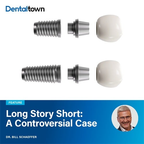 Long Story Short: A Controversial Case Dr. Bill Schaeffer revisits a once-criticized short implant case now thriving after 15 years 